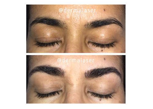 Microblading1