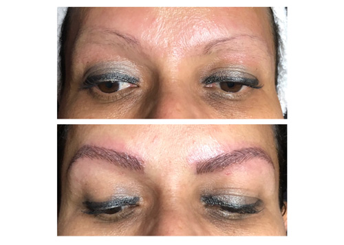 Microblading2