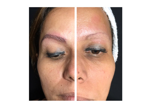 Microblading3