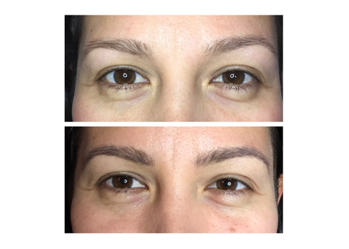 Microblading4