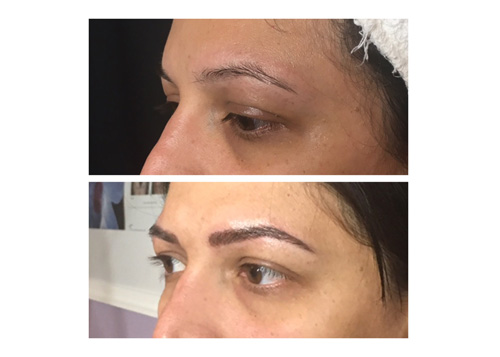 Microblading6