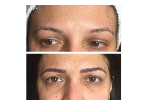 Microblading7